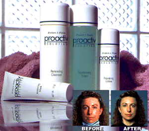 Proactiv Solution for Zits